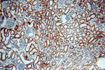 NDUFC2 Antibody in Immunohistochemistry (Paraffin) (IHC (P))