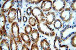 NDUFC2 Antibody in Immunohistochemistry (Paraffin) (IHC (P))