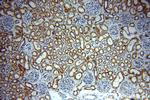 NDUFC2 Antibody in Immunohistochemistry (Paraffin) (IHC (P))