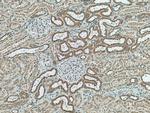 NDUFC2 Antibody in Immunohistochemistry (Paraffin) (IHC (P))