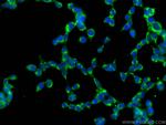 ALDH3A1 Antibody in Immunocytochemistry (ICC/IF)