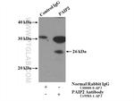 PAIP2 Antibody in Immunoprecipitation (IP)