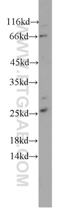 PAIP2 Antibody in Western Blot (WB)