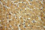 FDXR Antibody in Immunohistochemistry (Paraffin) (IHC (P))