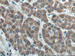 FDXR Antibody in Immunohistochemistry (Paraffin) (IHC (P))