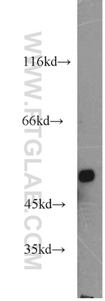 FDXR Antibody in Western Blot (WB)