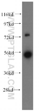 FDXR Antibody in Western Blot (WB)