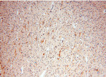 NDUFB10 Antibody in Immunohistochemistry (Paraffin) (IHC (P))