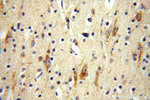 NDUFB10 Antibody in Immunohistochemistry (Paraffin) (IHC (P))