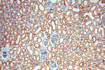 NDUFB10 Antibody in Immunohistochemistry (Paraffin) (IHC (P))