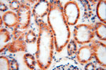 NDUFB10 Antibody in Immunohistochemistry (Paraffin) (IHC (P))