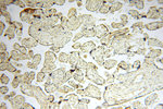 NDUFB10 Antibody in Immunohistochemistry (Paraffin) (IHC (P))