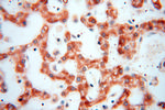 NDUFB10 Antibody in Immunohistochemistry (Paraffin) (IHC (P))