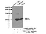 NDUFB10 Antibody in Immunoprecipitation (IP)