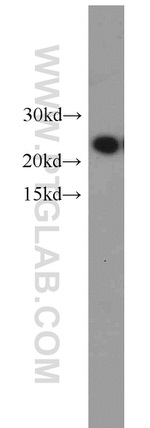 NDUFB10 Antibody in Western Blot (WB)