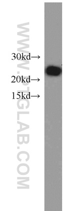 NDUFB10 Antibody in Western Blot (WB)