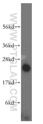 NDUFB10 Antibody in Western Blot (WB)