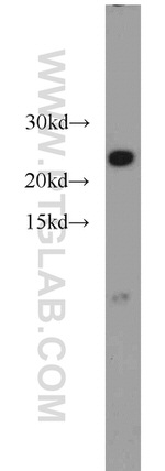 NDUFB10 Antibody in Western Blot (WB)