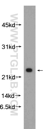 NDUFB10 Antibody in Western Blot (WB)