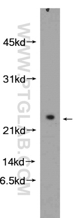 NDUFB10 Antibody in Western Blot (WB)