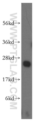 NDUFB10 Antibody in Western Blot (WB)