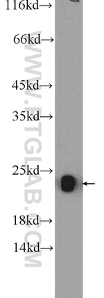 NDUFB10 Antibody in Western Blot (WB)