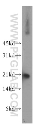 SELS Antibody in Western Blot (WB)