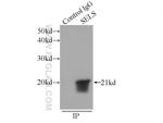 SELS Antibody in Immunoprecipitation (IP)