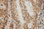 SF3A2 Antibody in Immunohistochemistry (Paraffin) (IHC (P))