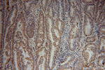 SF3A2 Antibody in Immunohistochemistry (Paraffin) (IHC (P))