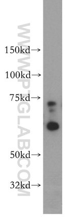 SF3A2 Antibody in Western Blot (WB)