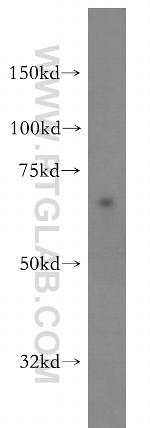 SF3A2 Antibody in Western Blot (WB)