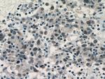 MCM3 Antibody in Immunohistochemistry (Paraffin) (IHC (P))