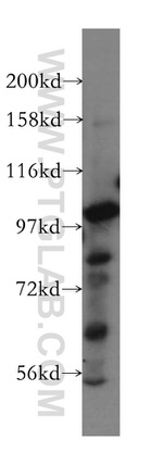 MCM3 Antibody in Western Blot (WB)