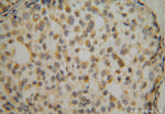 RPS16 Antibody in Immunohistochemistry (Paraffin) (IHC (P))