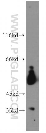 VRK3 Antibody in Western Blot (WB)