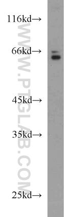 HAS3 Antibody in Western Blot (WB)