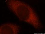 OXSR1 Antibody in Immunocytochemistry (ICC/IF)