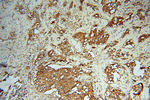 OXSR1 Antibody in Immunohistochemistry (Paraffin) (IHC (P))