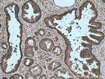 OXSR1 Antibody in Immunohistochemistry (Paraffin) (IHC (P))