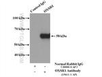 OXSR1 Antibody in Immunoprecipitation (IP)