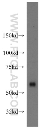 OXSR1 Antibody in Western Blot (WB)