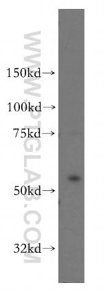 OXSR1 Antibody in Western Blot (WB)