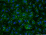 Fibronectin Antibody in Immunocytochemistry (ICC/IF)