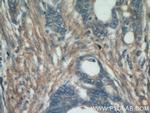 Fibronectin Antibody in Immunohistochemistry (Paraffin) (IHC (P))