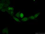 PRC1 Antibody in Immunocytochemistry (ICC/IF)