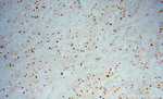 PRC1 Antibody in Immunohistochemistry (Paraffin) (IHC (P))