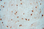 PRC1 Antibody in Immunohistochemistry (Paraffin) (IHC (P))