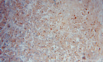 PRC1 Antibody in Immunohistochemistry (Paraffin) (IHC (P))