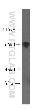 PRC1 Antibody in Western Blot (WB)